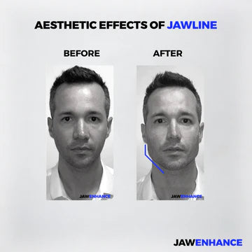 Jaw Enhance - Ultimate Facial Exerciser