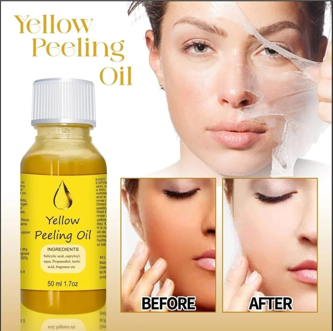 YELLOW®- PEELING OIL(Buy 1 Get 1 Free)