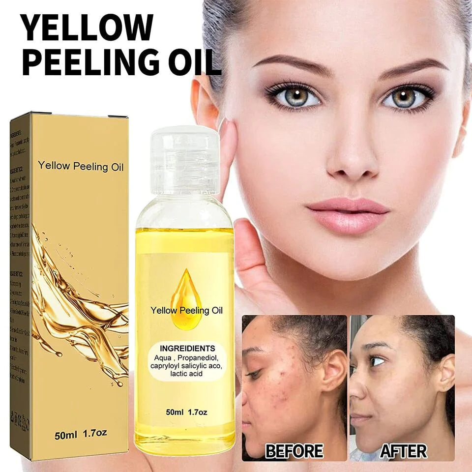 YELLOW®- PEELING OIL(Buy 1 Get 1 Free)